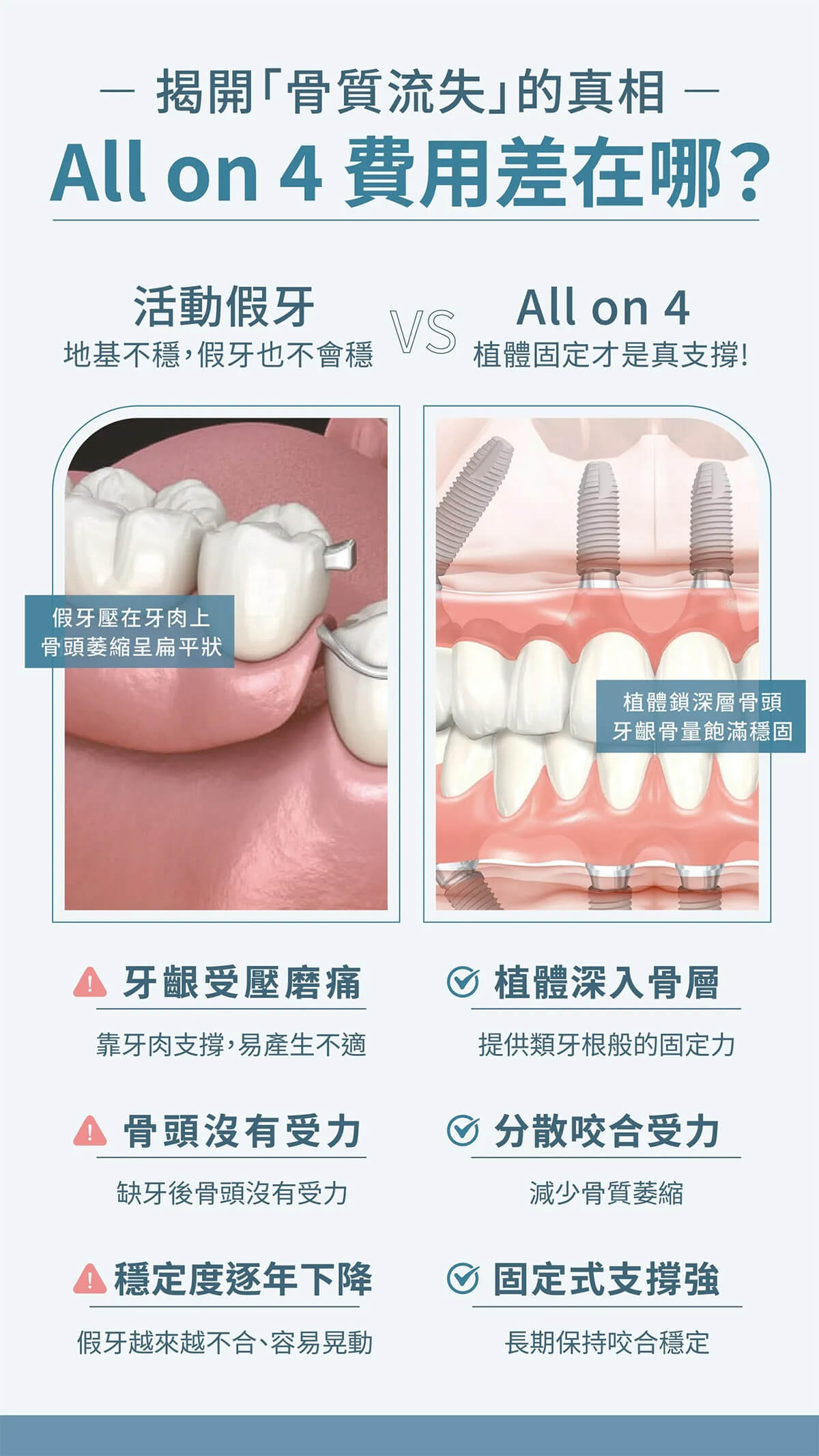  嚴重牙周病患者選擇傳統植牙與 All-on-4 全口重建的差異比較