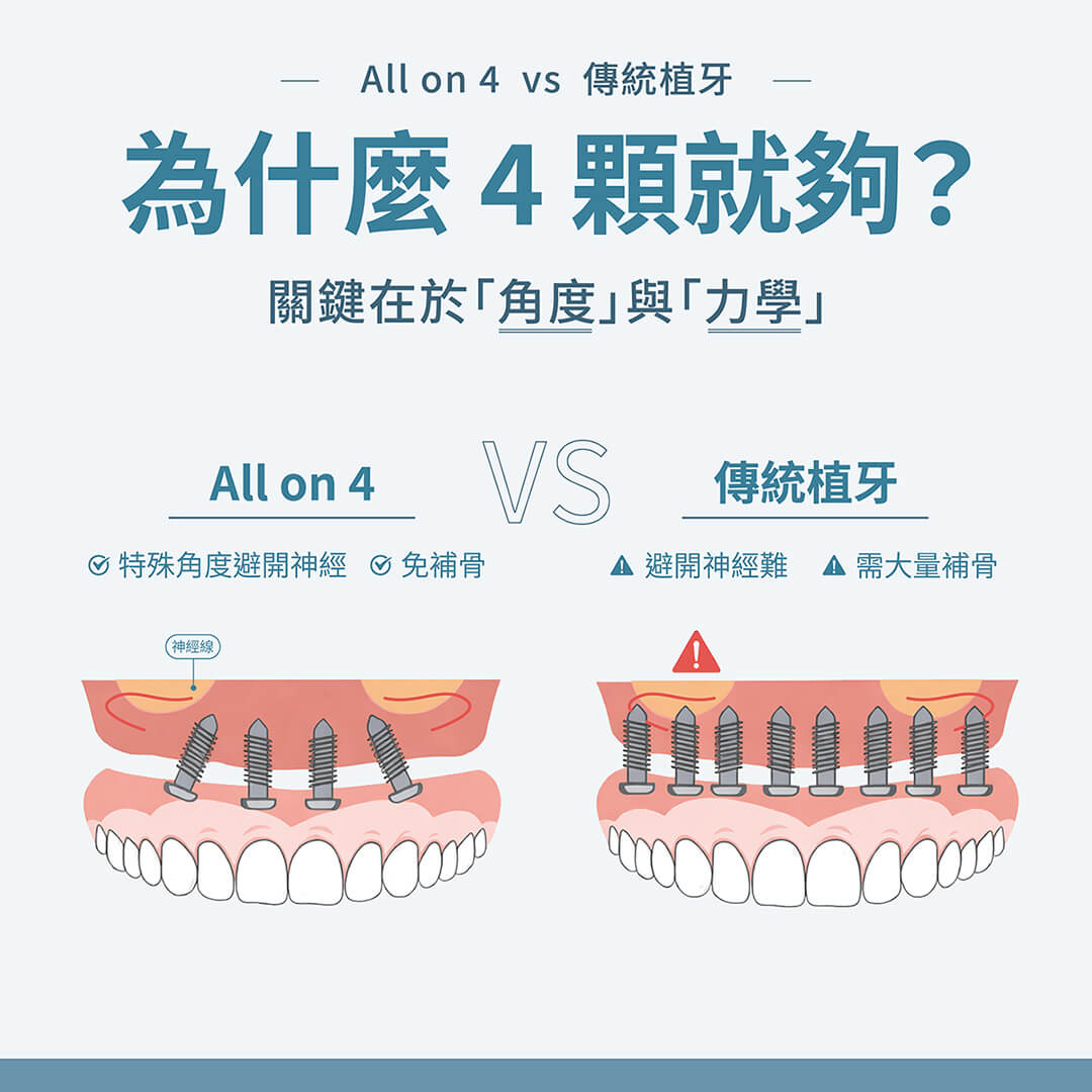 關鍵在於「角度」與「力學」